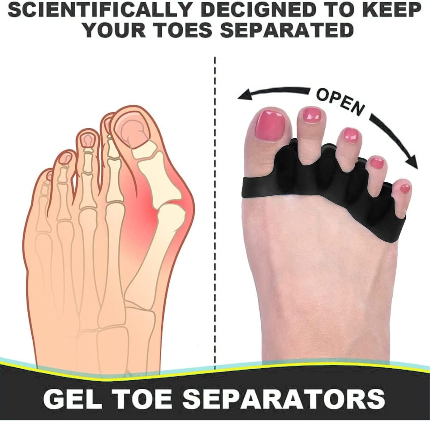 Premium Toe Separators – Gel Toe Spacers – Bunion Corrector – Hammer Toe Straightener – Toe Stretcher – Unisex