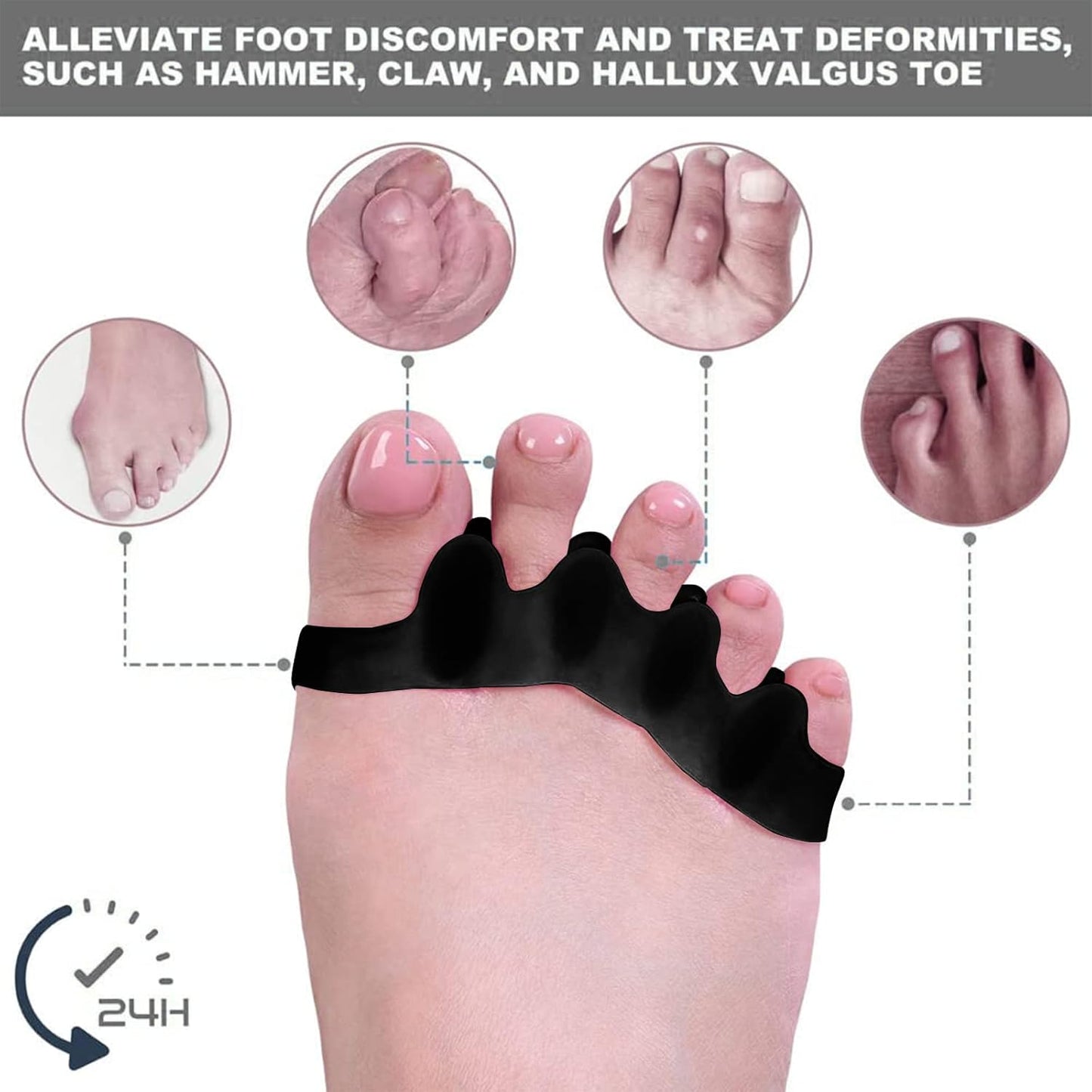 Premium Toe Separators – Gel Toe Spacers – Bunion Corrector – Hammer Toe Straightener – Toe Stretcher – Unisex